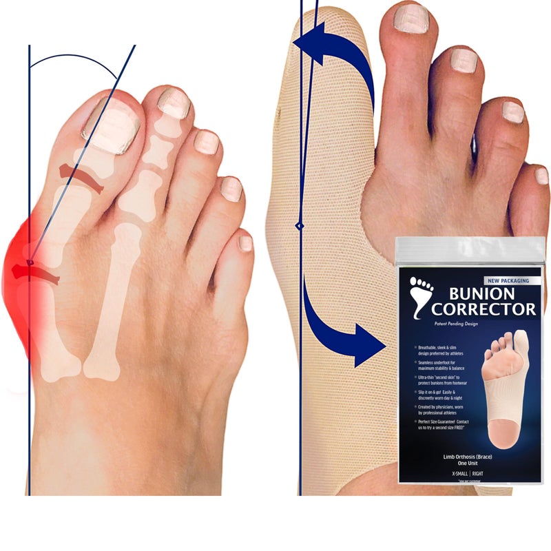 Bunion Bootie مصحح بونيون للنساء لتقويم إصبع القدم الكبير. دعامة بونيون رفيعة للغاية. جورب مناسب للأحذية لتصحيح البونيون. لجميع أنواع الأحذية. تخفيف هالوكس فالغوس لتحسين محاذاة الأصابع. - Image 1